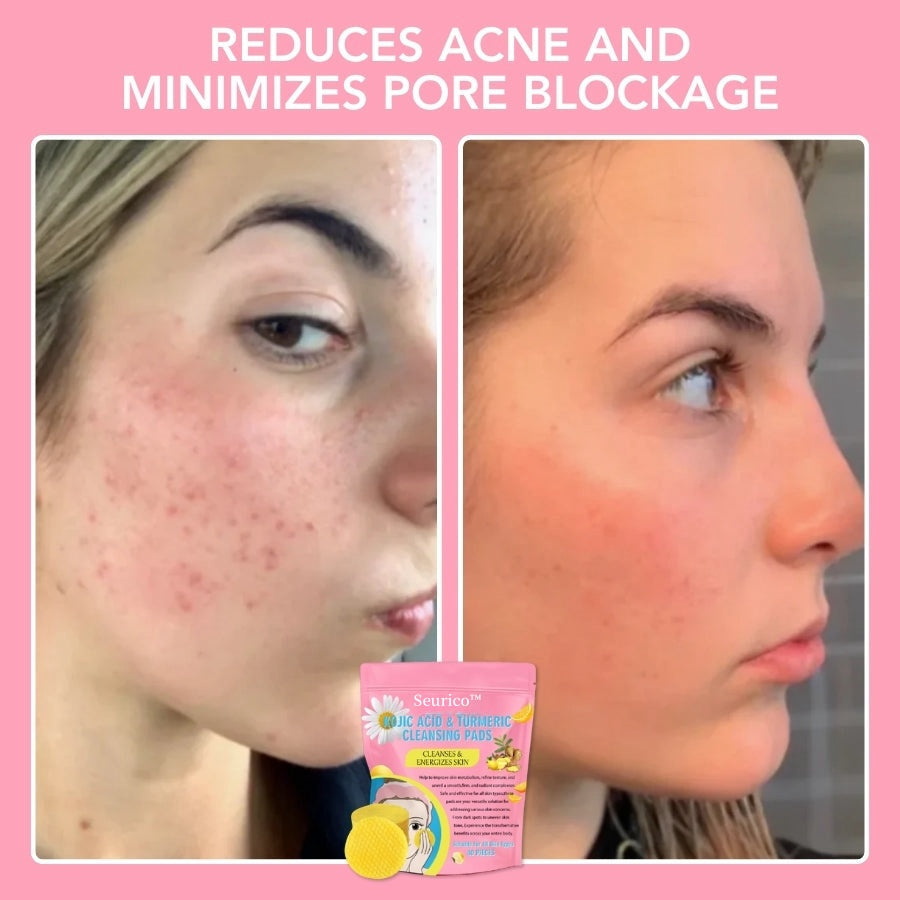 Seurico™ Turmeric Kojic Acid Cleansing Pads
