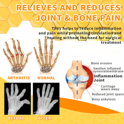 Bee Venom Joint Therapy Pain Relief Gel (New Zealand Bee Extract - Specializes in Orthopedic Diseases and Arthritis Pain)