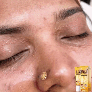 🏆 Seurico™ Collagen+ Bee Venom Anti-Sagging Lifting Wake Up Eye Cream 🐝