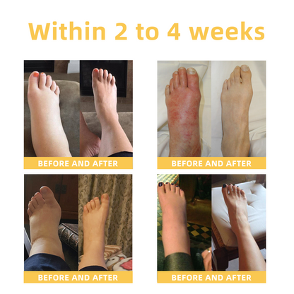 Seurico™ Arthritis and Varicose Vein Treatment Cream