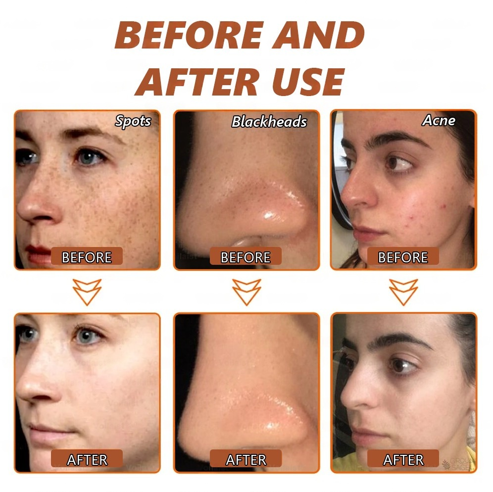 Zakdavi™ Radiant Whitening &amp; Spot Eraser Mask is 100% natural and USDA Organic certified, crafted with organic, biodynamic, and ethically sourced ingredients.