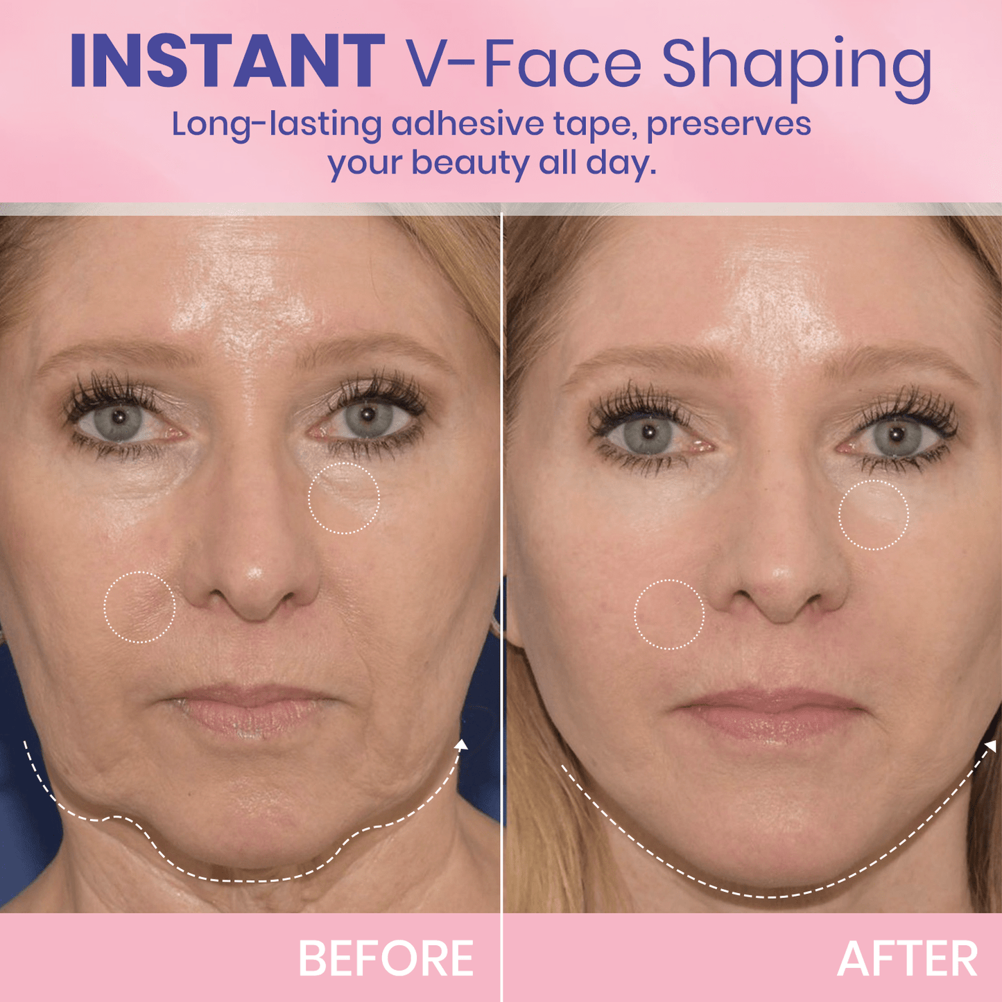 Seurico™ V-Face Lifting Adhesive Tape — Discreet, Waterproof Face Slimming Strips