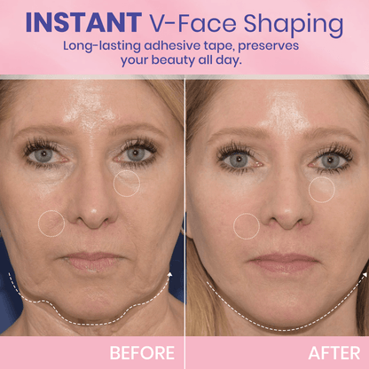 Seurico™ V-Face Lifting Adhesive Tape — Discreet, Waterproof Face Slimming Strips