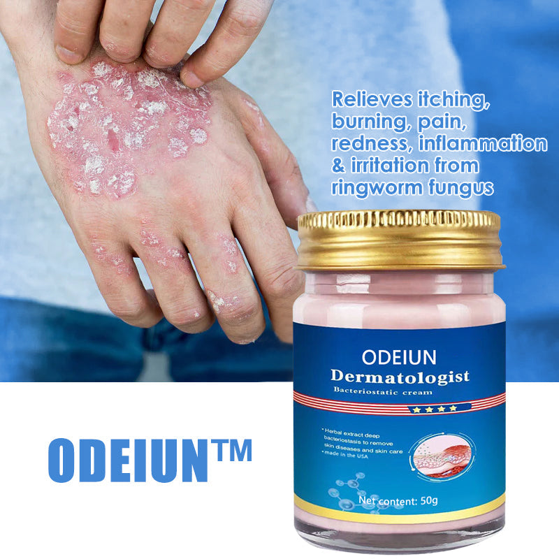 🔥ODEIUM™ Psoriasis Treatment Cream🔥 (for all skin conditions)