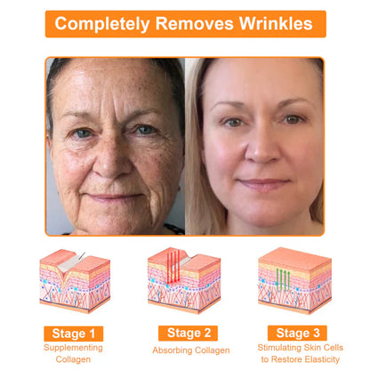 🐂[Official Store] ODEIUN Beef Tallow Repair Treatment Cream