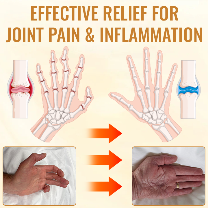 SEURICO™ Bee Venom Joint & Bone Therapy Cream — Targeted Relief and Recovery Backed by Science