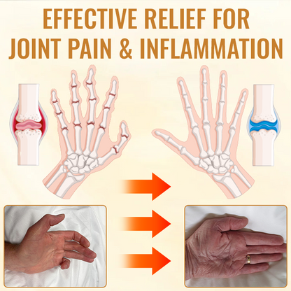 SEURICO™ Bee Venom Joint & Bone Therapy Cream — Targeted Relief and Recovery Backed by Science