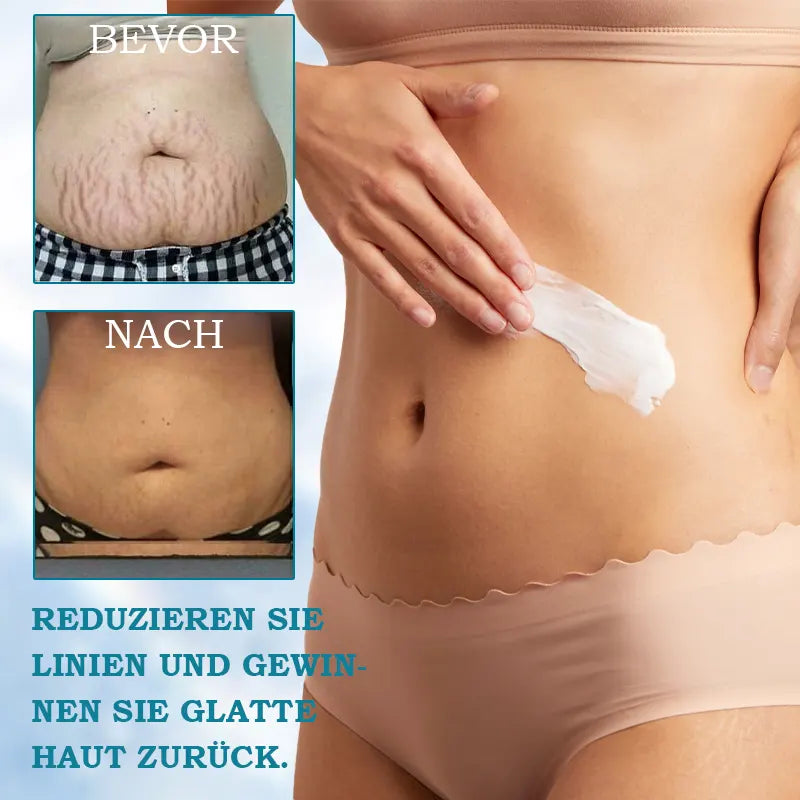 🩵𝐋𝐚𝐬𝐭 𝐃𝐚𝐲 𝐃𝐢𝐬𝐜𝐨𝐮𝐧𝐭: 𝟖𝟕% 𝐎𝐅𝐅🌸𝗝𝗘𝗥𝗘𝗠𝗬𝗧𝗜𝗦™ 𝐀𝐝𝐯𝐚𝐧𝐜𝐞𝐝 𝐅𝐢𝐫𝐦𝐢𝐧𝐠 & 𝐖𝐫𝐢𝐧𝐤𝐥𝐞-𝐑𝐞𝐝𝐮𝐜𝐢𝐧𝐠 𝐂𝐫𝐞𝐚𝐦: 𝗥𝗲𝘀𝘁𝗼𝗿𝗲 𝗦𝗸𝗶𝗻 𝗘𝗹𝗮𝘀𝘁𝗶𝗰𝗶𝘁𝘆⭐