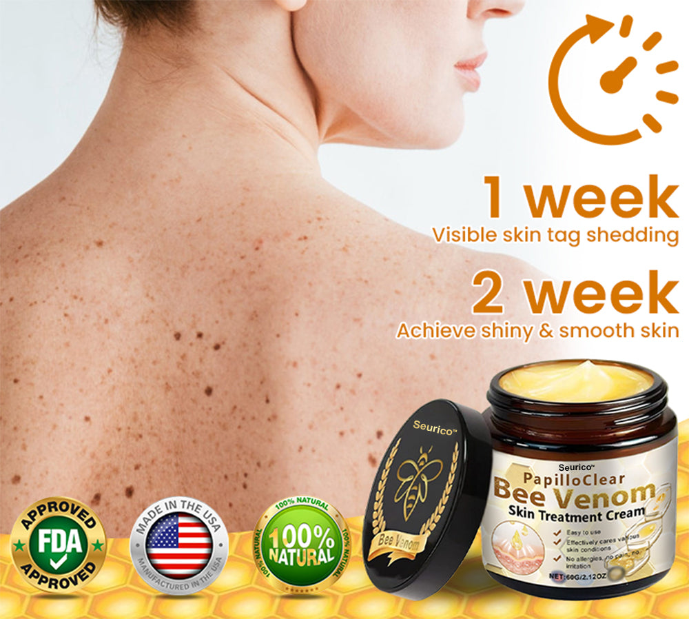 🎉[Official Store] 🎄 Holiday Sale Extravaganza: Enjoy 50% Off! 🎁Bee Venom Mole and Wart Cream