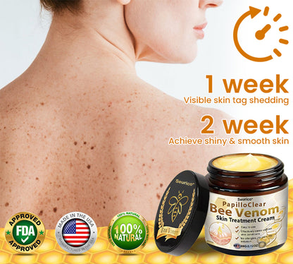 🎉[Official Store] 🎄 Holiday Sale Extravaganza: Enjoy 50% Off! 🎁Bee Venom Mole and Wart Cream