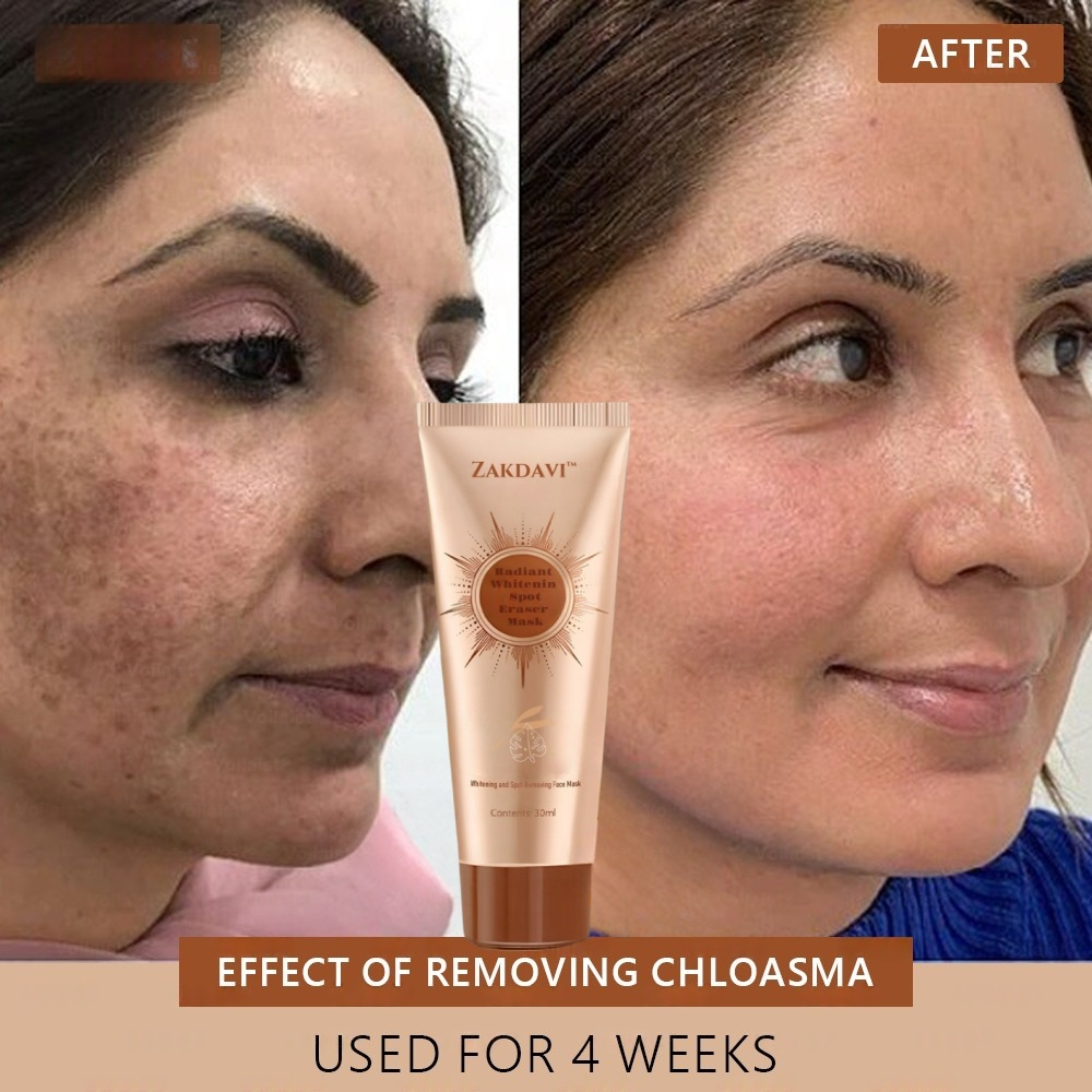 Zakdavi™ Radiant Whitening &amp; Spot Eraser Mask is 100% natural and USDA Organic certified, crafted with organic, biodynamic, and ethically sourced ingredients.