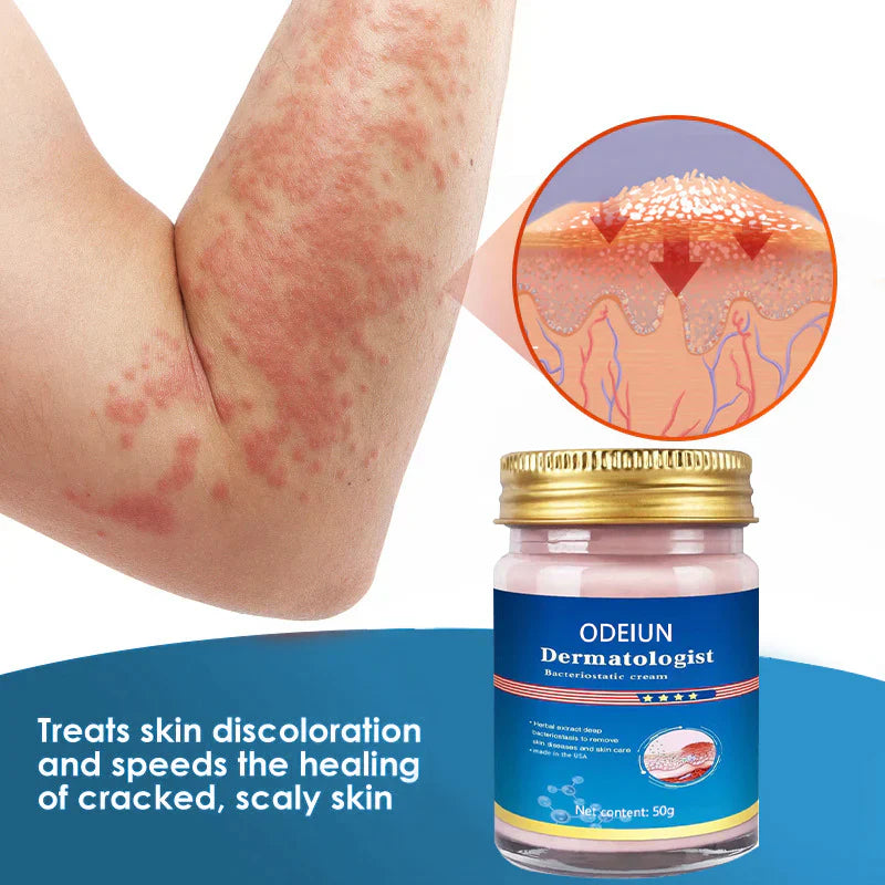 🔥ODEIUM™ Psoriasis Treatment Cream🔥 (for all skin conditions)