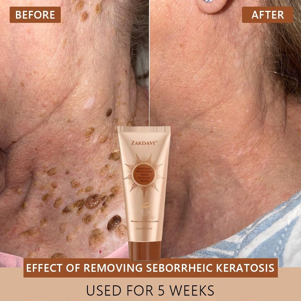 Zakdavi™ Radiant Whitening &amp; Spot Eraser Mask is 100% natural and USDA Organic certified, crafted with organic, biodynamic, and ethically sourced ingredients.