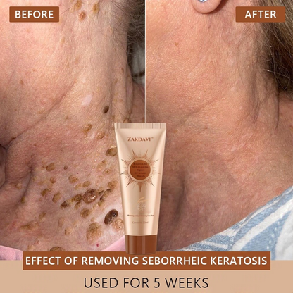 Zakdavi™ Radiant Whitening &amp; Spot Eraser Mask is 100% natural and USDA Organic certified, crafted with organic, biodynamic, and ethically sourced ingredients.