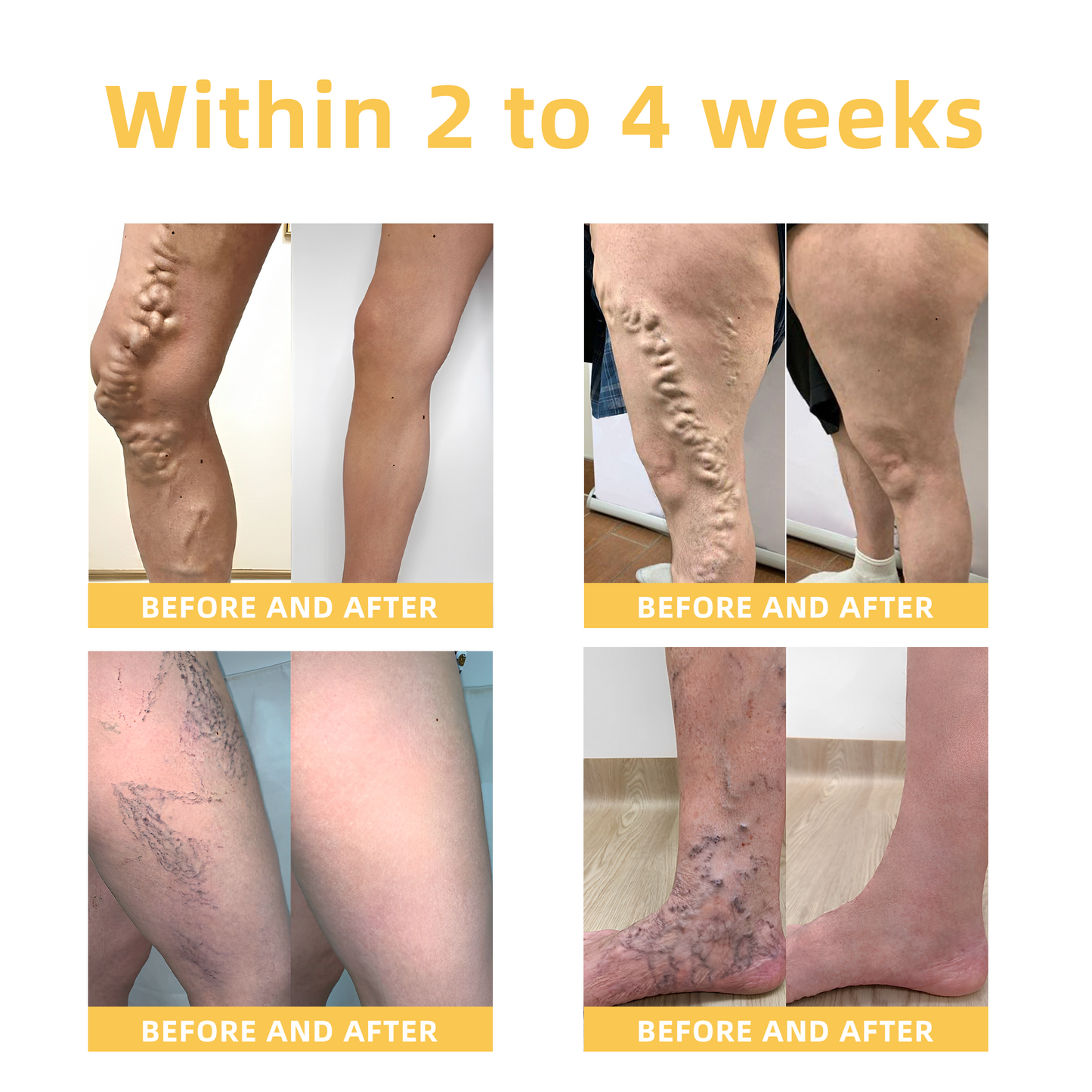 Seurico™ Arthritis and Varicose Vein Treatment Cream