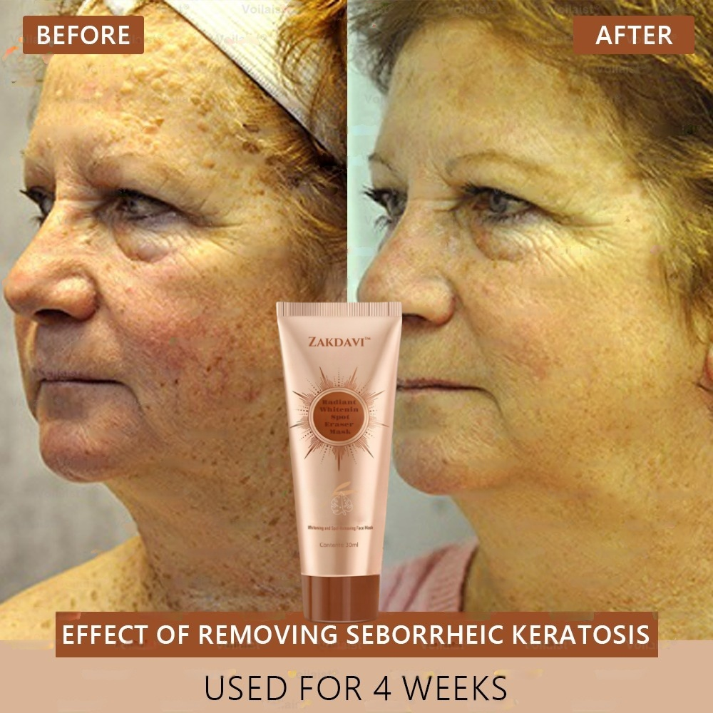 Zakdavi™ Radiant Whitening &amp; Spot Eraser Mask is 100% natural and USDA Organic certified, crafted with organic, biodynamic, and ethically sourced ingredients.