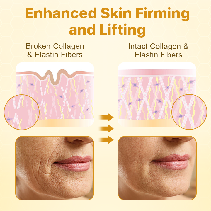 🎄 Holiday Sale Extravaganza: Enjoy 50% Off! 🎁 Off  BotoxLux Bee Venom Lift Cream