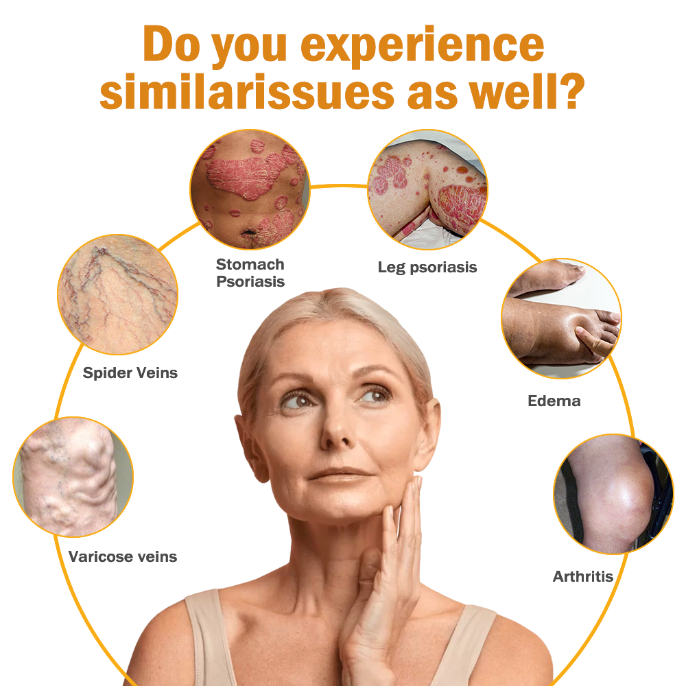 Seurico™ Arthritis and Varicose Vein Treatment Cream