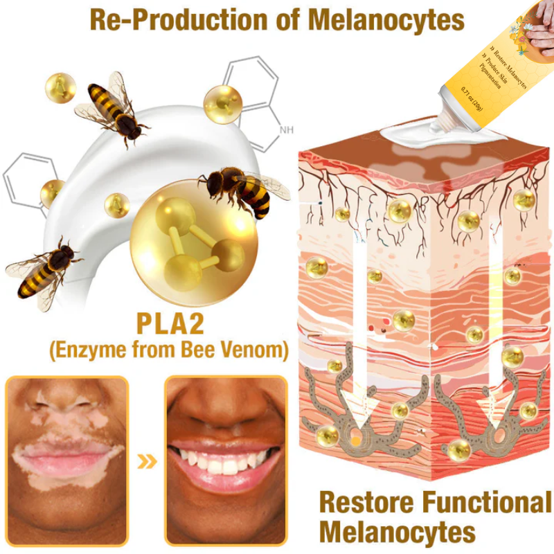 Seurico™ Bee Venom Vitiligo Treatment Cream