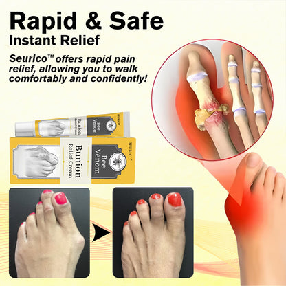 Seurico™ Bee Venom Bunion Relief Cream