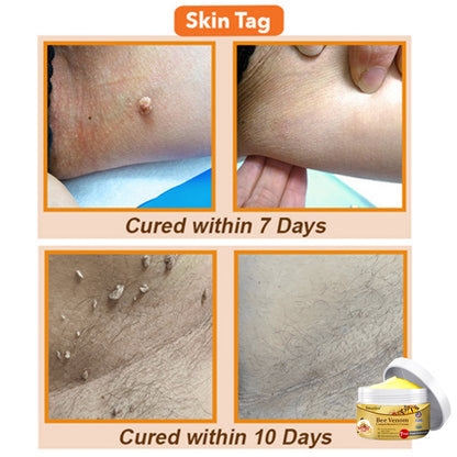 💕🐝Seurico™ Bee Venom Comprehensive Cream 🇺🇸 Dermatologist Recommended