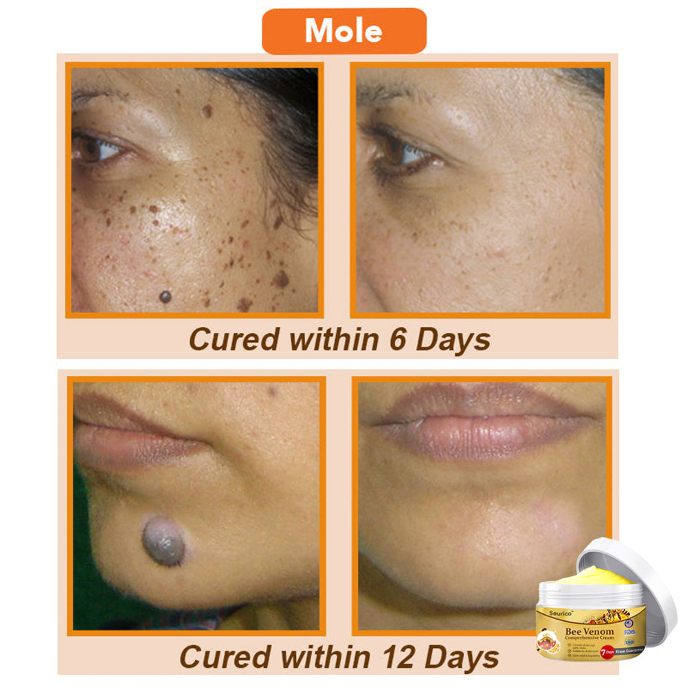 💕🐝Seurico™ Bee Venom Comprehensive Cream 🇺🇸 Dermatologist Recommended