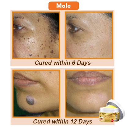 💕🐝Seurico™ Bee Venom Comprehensive Cream 🇺🇸 Dermatologist Recommended