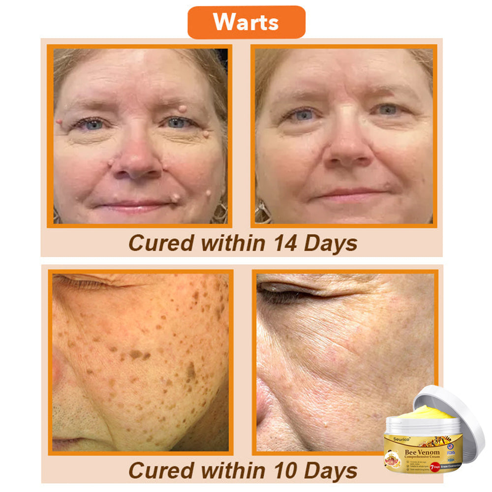 💕🐝Seurico™ Bee Venom Comprehensive Cream 🇺🇸 Dermatologist Recommended