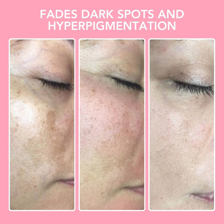 Seurico™ Turmeric Kojic Acid Cleansing Pads