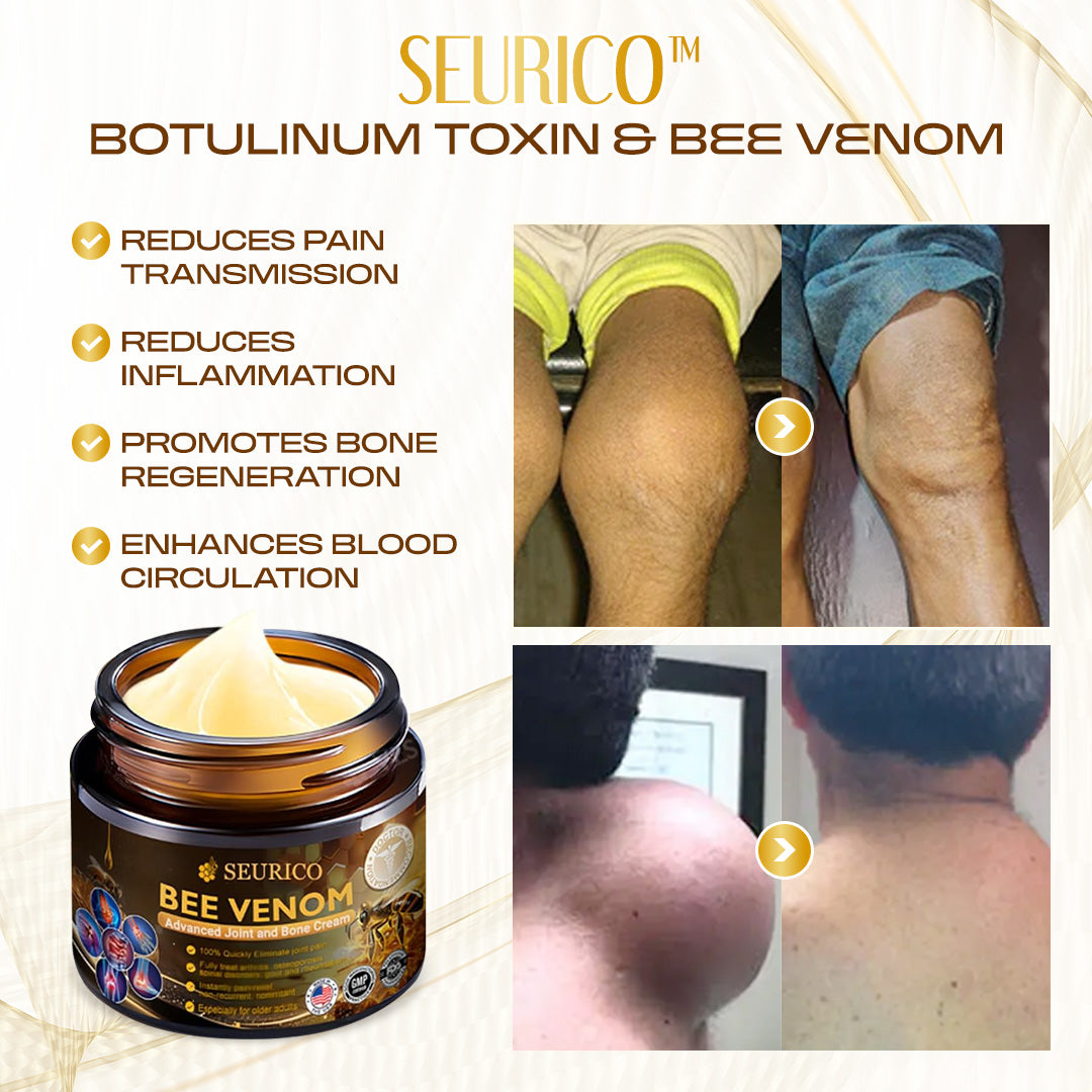 💪 Experience Natural Pain Relief and Enhanced Mobility with Seurico™ Bee Venom Therapy