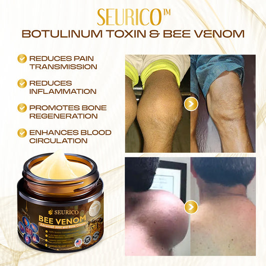 💪 Experience Natural Pain Relief and Enhanced Mobility with Seurico™ Bee Venom Therapy