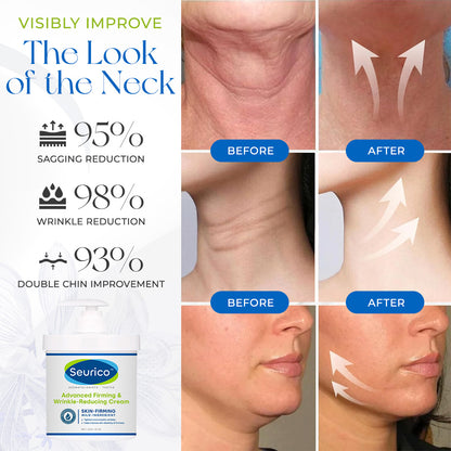 Seurico® Advanced Firming & Wrinkle-Reducing Cream: Restore Skin Elasticity