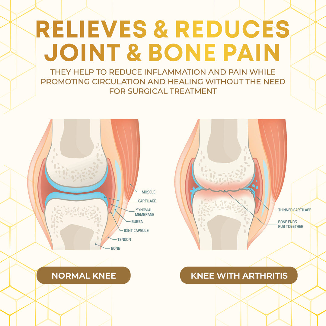 Seurico™ Bee Venom Joint Therapy Pain Relief Gel 🐝🔥