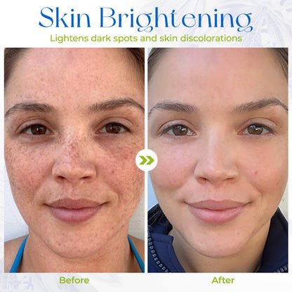 Seurico™ Advanced Firming & Wrinkle-Reducing Cream(Restore Skin Elasticity)