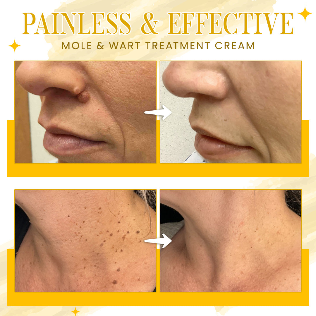 Seurico™ Bee Venom Skin Treatment – Dermatologist-Backed Results