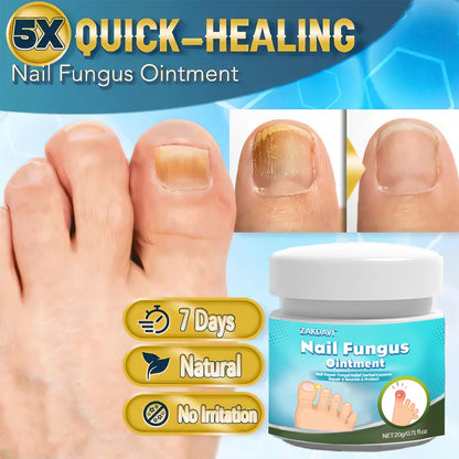 ⏱️✨ Zakdavi™ Nail Fungus Ointment — 5X Faster Healing for Clear Nails