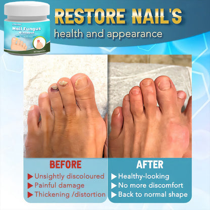 ⏱️✨ Zakdavi™ Nail Fungus Ointment — 5X Faster Healing for Clear Nails