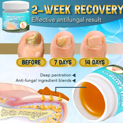⏱️✨ Zakdavi™ Nail Fungus Ointment — 5X Faster Healing for Clear Nails