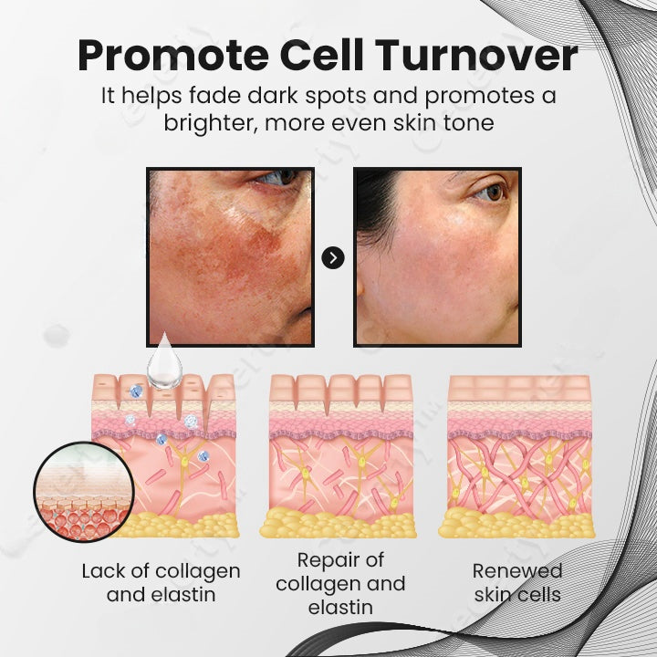 Seurico™ Dark Spot Remover Serum