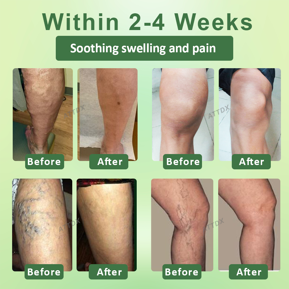 Seurico™ Circulation Max Tourmaline Fiber Leg Sleeves