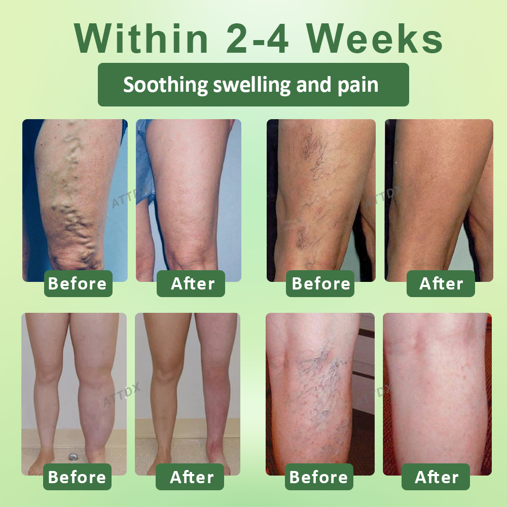 Seurico™ Circulation Max Tourmaline Fiber Leg Sleeves