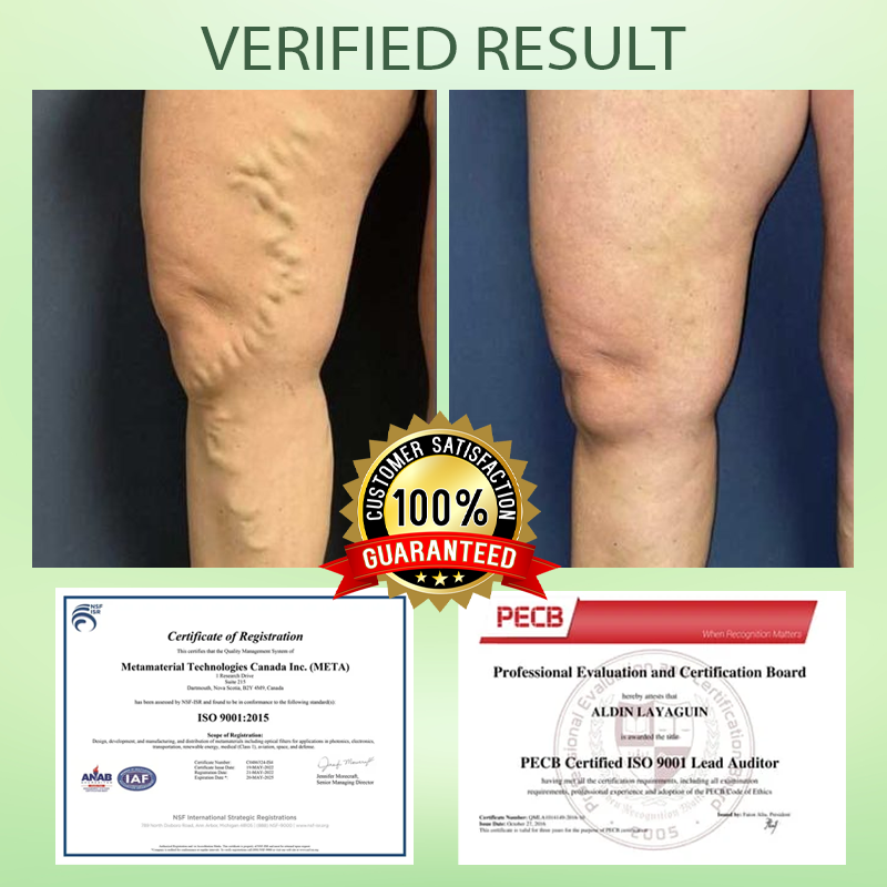 Seurico™ Circulation Max Tourmaline Fiber Leg Sleeves