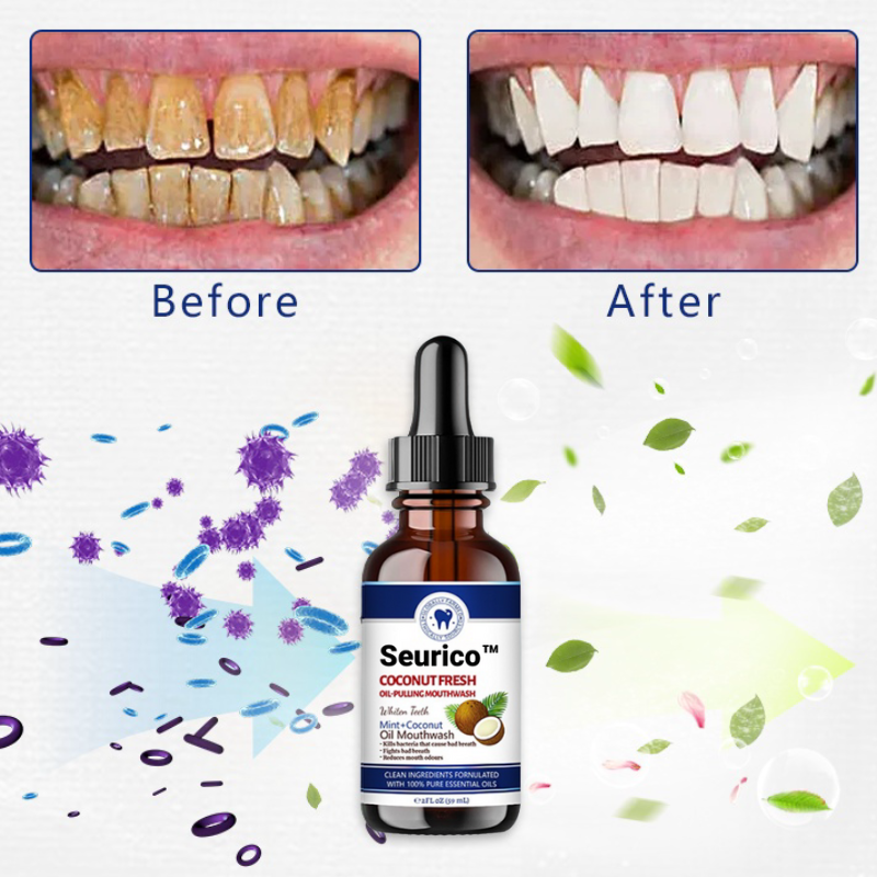 🎄 Holiday Sale Extravaganza: Enjoy 50% Off! 🎁  Coconut Oil-Pulling Mouthwash