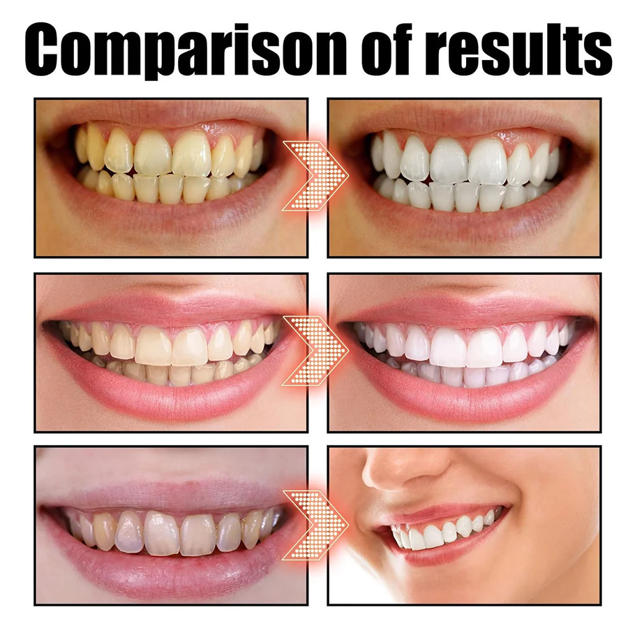 🎄 Holiday Sale Extravaganza: Enjoy 50% Off! 🎁  POWERFUL ORGANIC COCONUT + PEPPERMINT PULLING OIL 4 OZ (✨ Advanced Formula for Fresher Breath and Healthier Gums ✨)