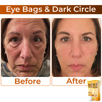 🏆 Seurico™ Collagen+ Bee Venom Anti-Sagging Lifting Wake Up Eye Cream 🐝