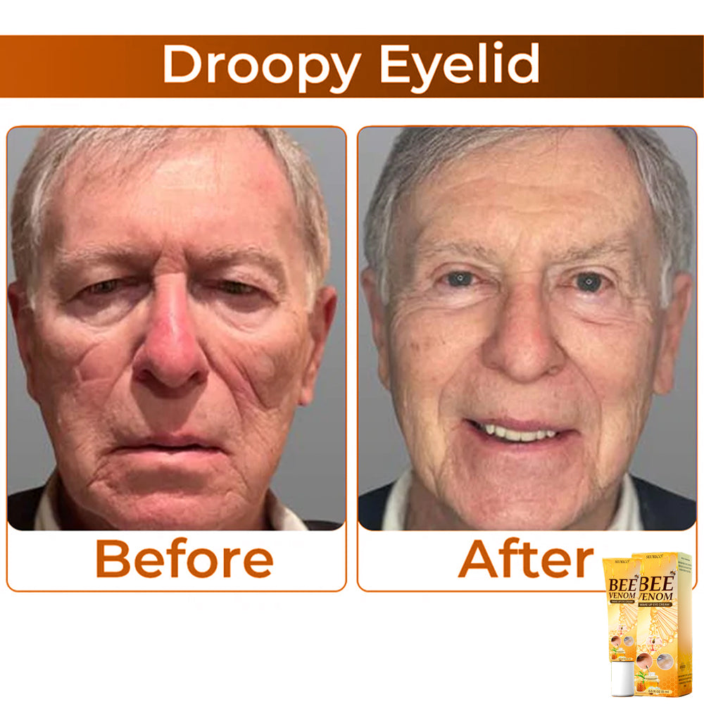 🏆 Seurico™ Collagen+ Bee Venom Anti-Sagging Lifting Wake Up Eye Cream 🐝