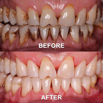 ✅ Seurico™ Gum Repair & Oral Health Powder (CE Certified for Periodontitis, Mouth Sores, and Gum Recession)