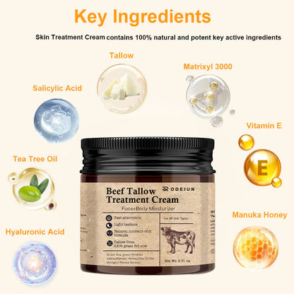 🐂[Official Store] ODEIUN Beef Tallow Repair Treatment Cream