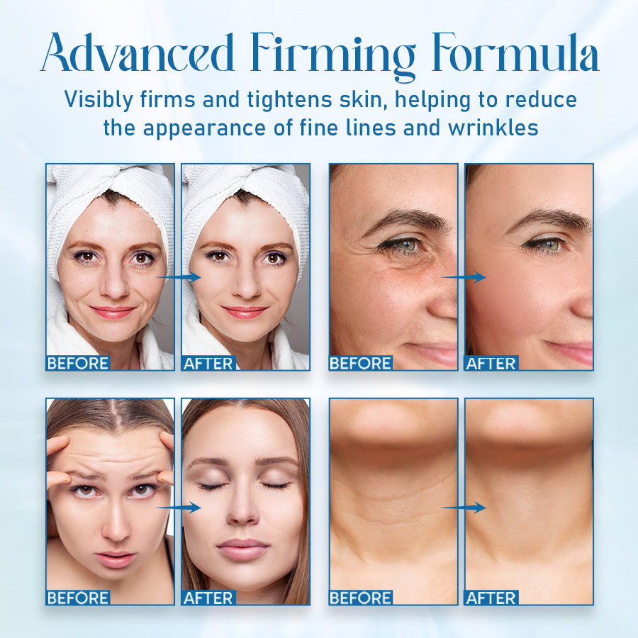 🎄 Holiday Sale Extravaganza: Enjoy 50% Off! 🎁  Seurico™ Ultra Firming & Revitalizing Cream: Renew Skin Firmness