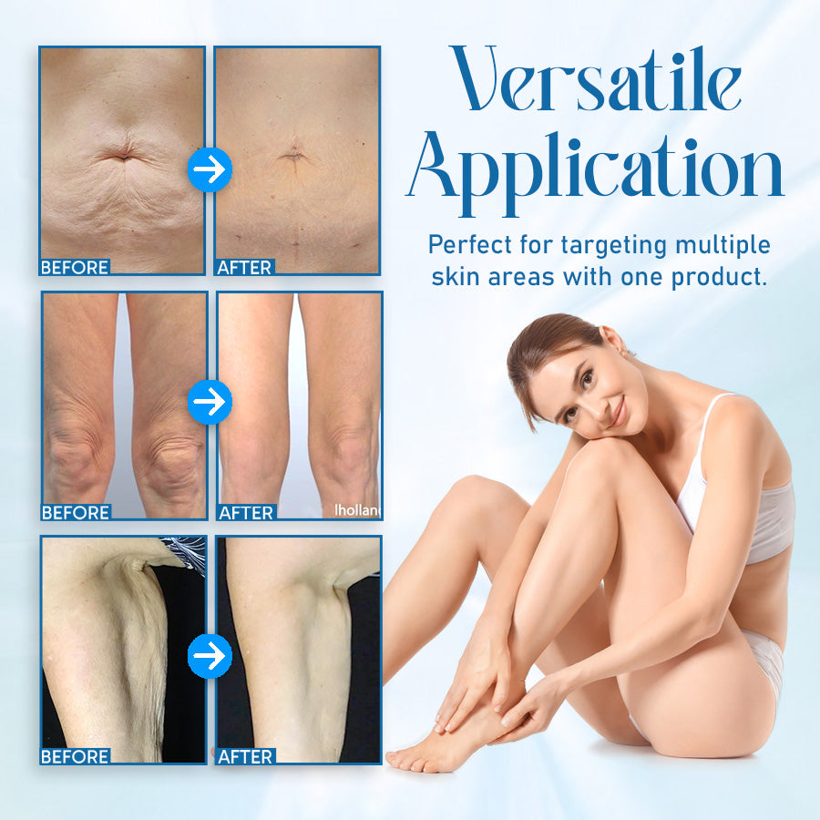 🎄 Holiday Sale Extravaganza: Enjoy 50% Off! 🎁  Seurico™ Ultra Firming & Revitalizing Cream: Renew Skin Firmness